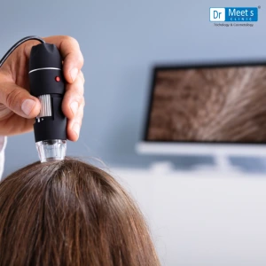 Best Hair Loss Treatments