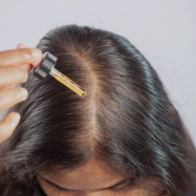 hair fall treatment