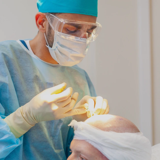 best hair specialist doctor in Indore