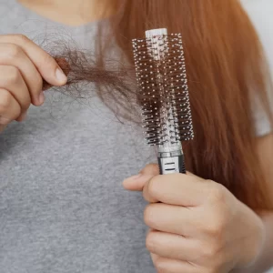 Best Hair Loss Treatments in Indore