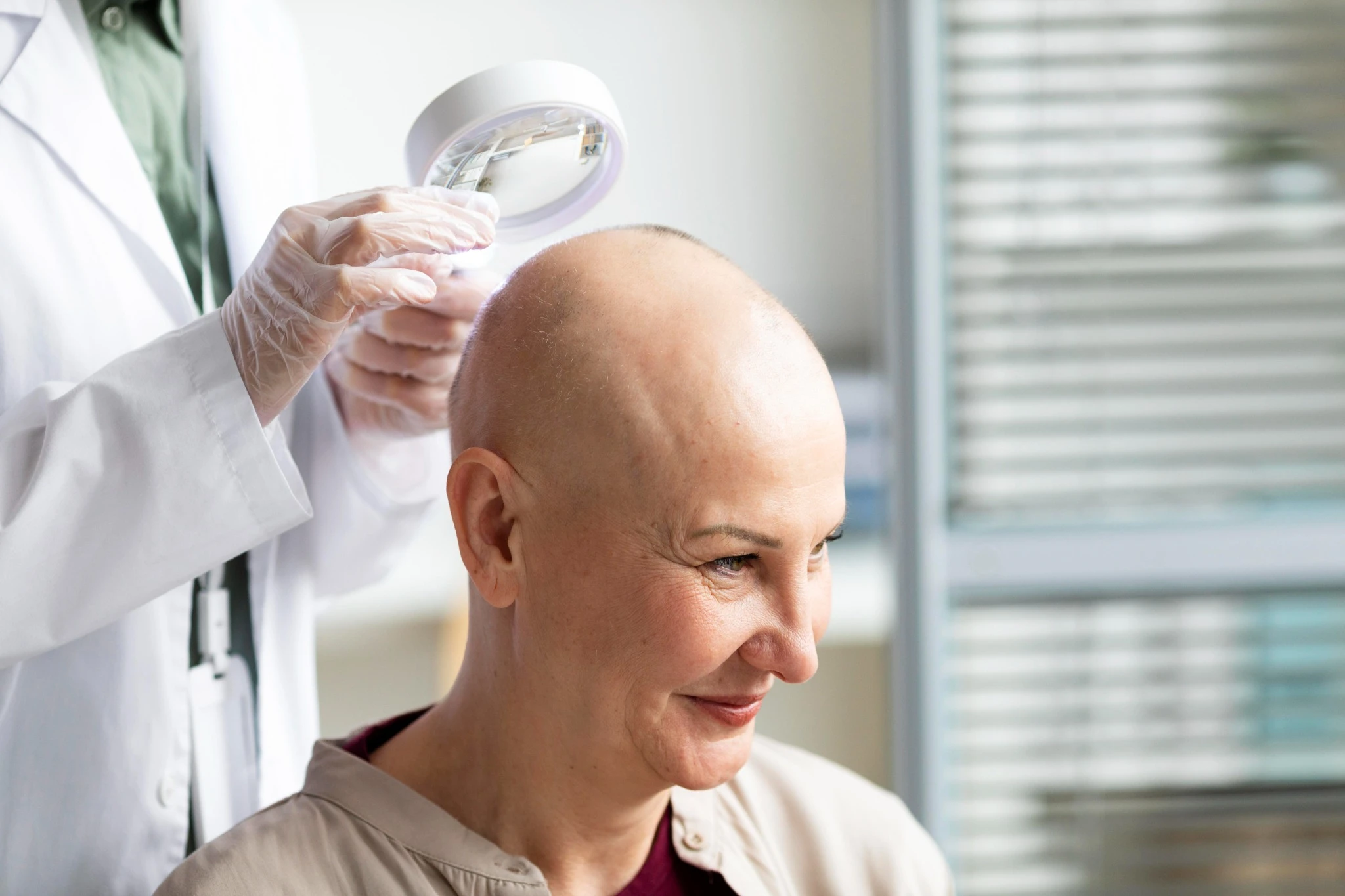 alopecia treatment in Indore