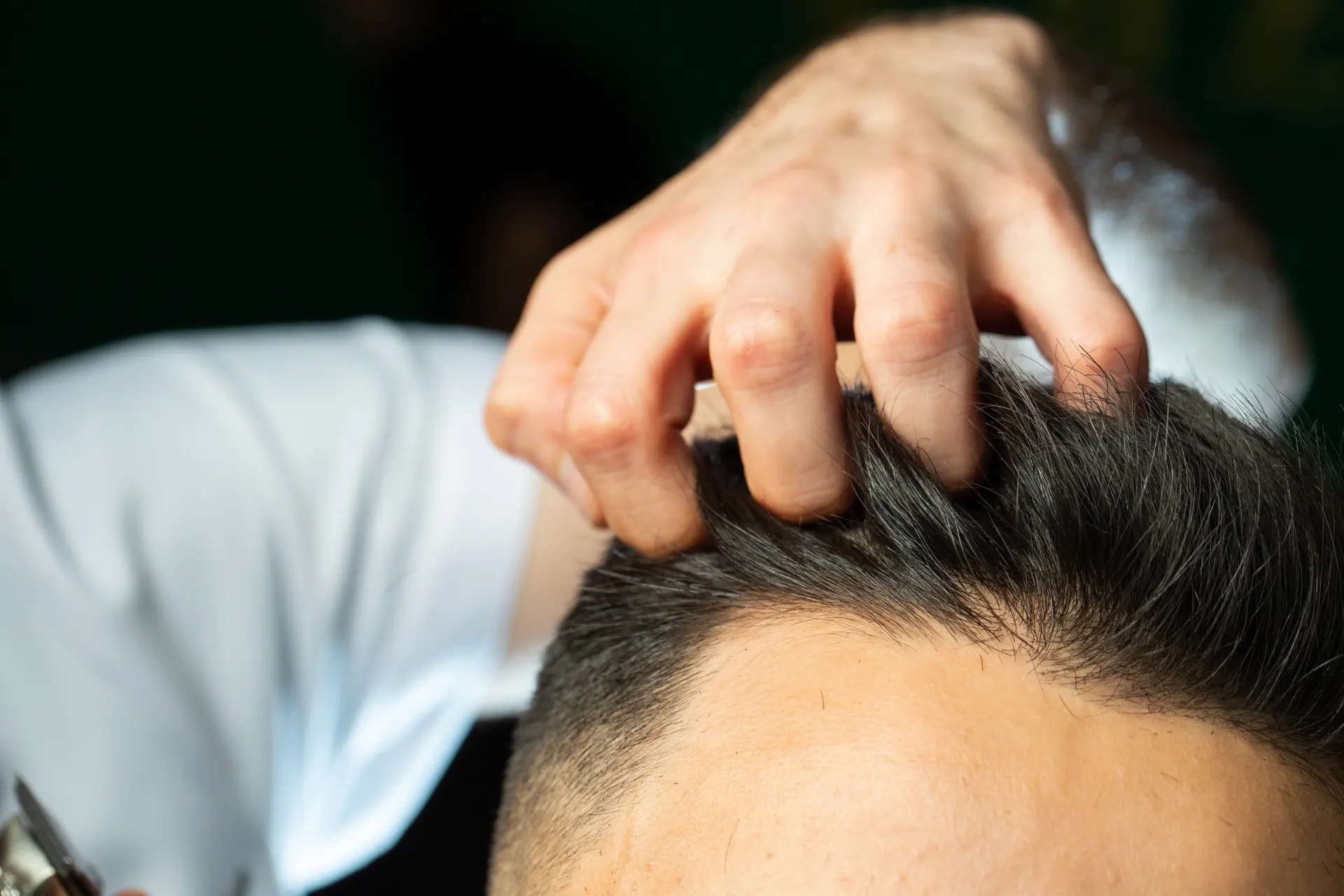 hair loss treatment in Indore