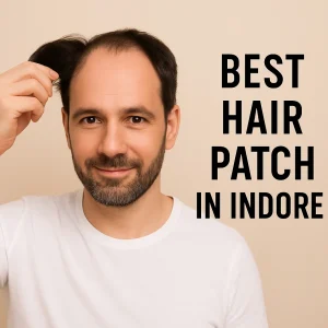 Best Hair Patch in Indore