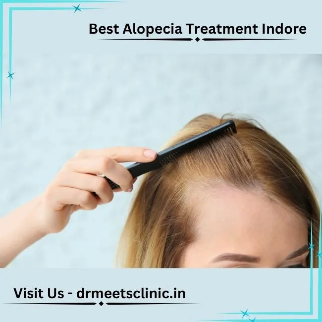 Best Alopecia Treatment Indore